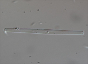 Fragilaria diatom after ultrasound treatment