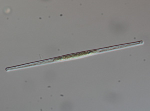 fragilaria diatom
