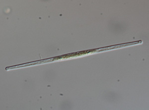 Fragilaria sp fragilaria diatom