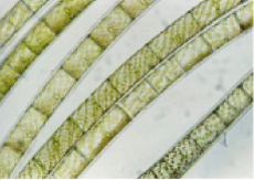 Spirogyra cells